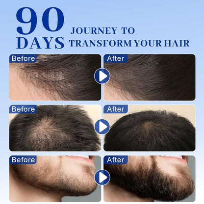 Copper Peptides Hair Growth Serum Women and Men for Thinning Hair | Promotes Fullness Reduces Shedding 30ml / 1fl oz